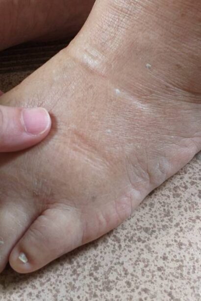 ce sa mananci sa scapi de retentia de apa si balonarea din timpul verii alimente care elimina fluidele toxice din corp 688b7f35305a9