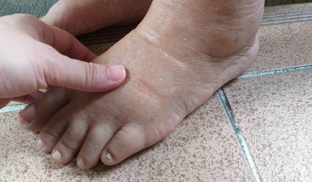 ce sa mananci sa scapi de retentia de apa si balonarea din timpul verii alimente care elimina fluidele toxice din corp 688b7f35305a9