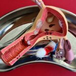 ce sa mananci daca ai trecut printr o histerectomie alimente vindecatoare care te ajuta sa ti recapeti forta 689a142c4c924