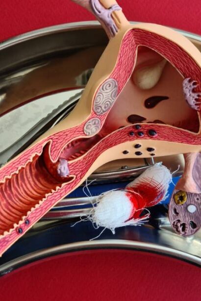 ce sa mananci daca ai trecut printr o histerectomie alimente vindecatoare care te ajuta sa ti recapeti forta 689a142c4c924