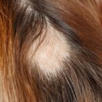 bauturile din supermarket care te pot lasa fara par studiul care arata riscurile pentru podoaba capilara 68b5a3e684cbc