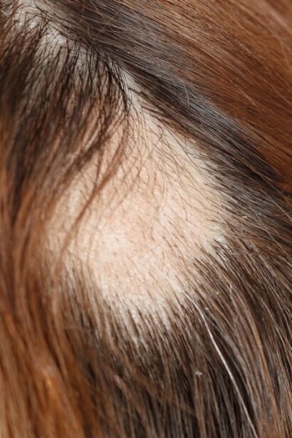 bauturile din supermarket care te pot lasa fara par studiul care arata riscurile pentru podoaba capilara 68b5a3e684cbc